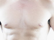 男性女乳症手術 台北亞緻TaipeiArts