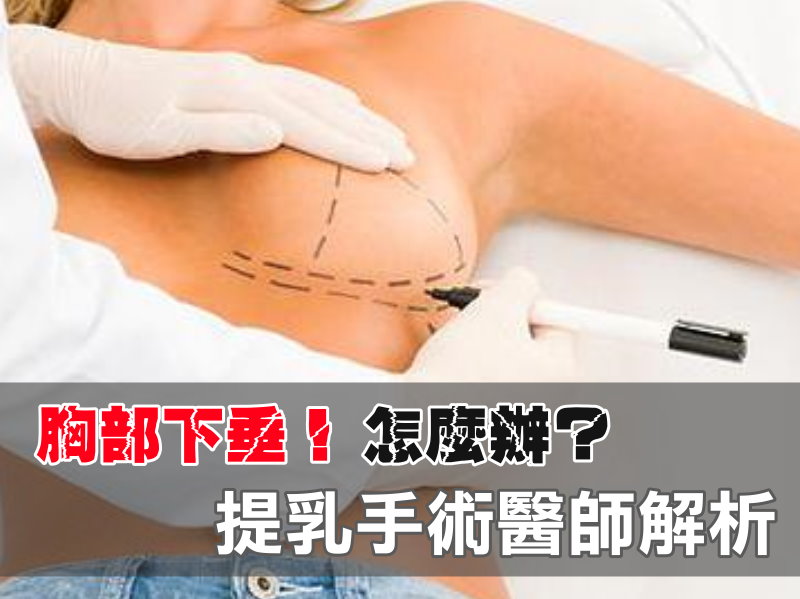 提乳手術是什麼？費用價格價錢價位是多少？手術後會有疤痕嗎？