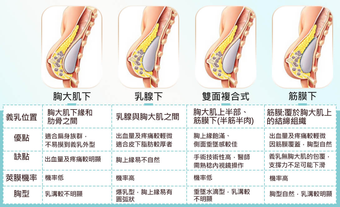 豐胸隆乳手術個別差異性