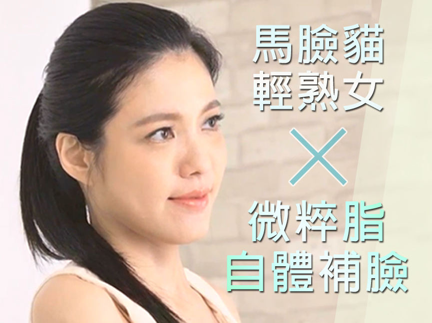 馬臉業務自體脂肪豐頰補臉