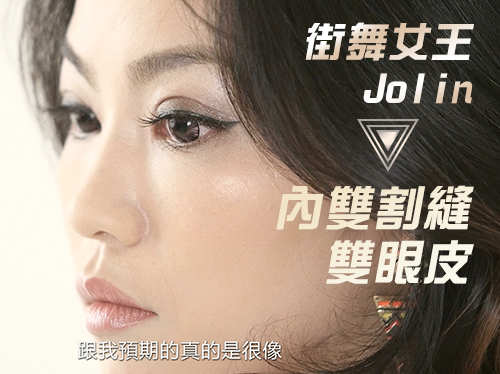 內雙Jolin割縫雙眼皮全紀錄