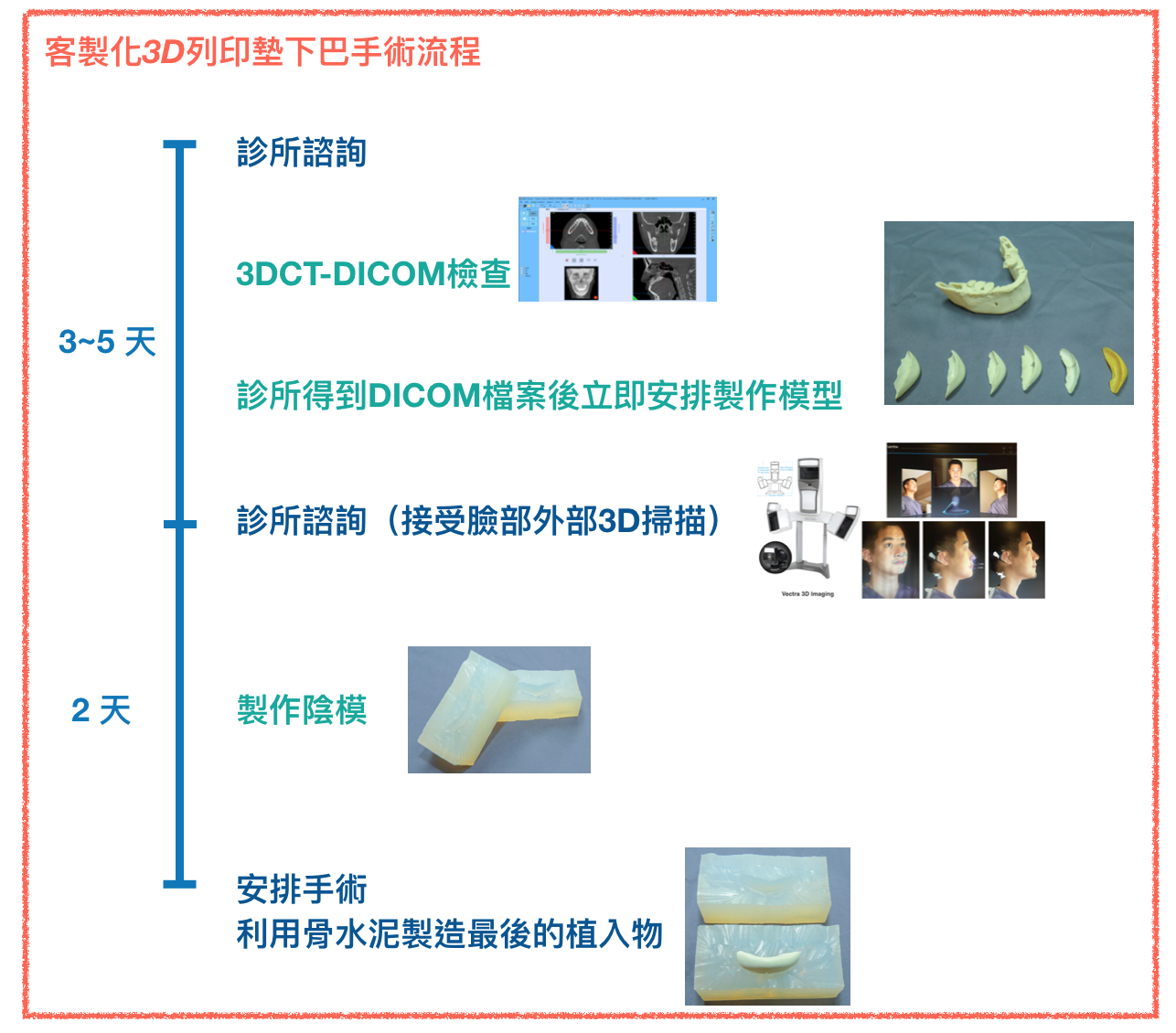 3d墊下巴流程