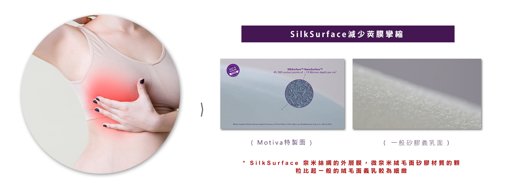 SilkSurface減少莢膜攣縮  SilkSurface 奈米絲綢的外層膜，微奈米絨毛面矽膠材質的顆粒比起一般的絨毛面義乳較為細緻