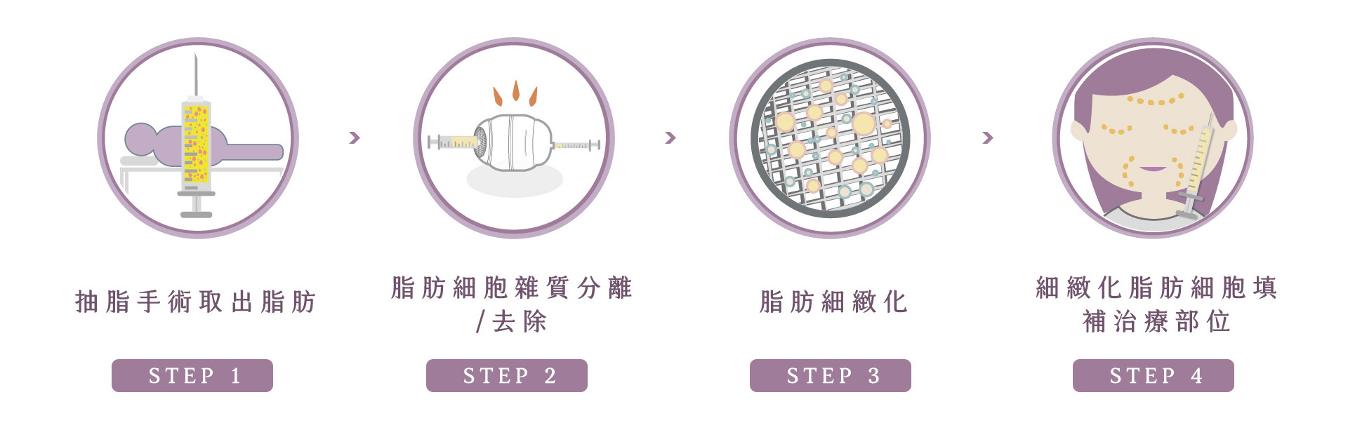 威萃細胞溶液治療流程