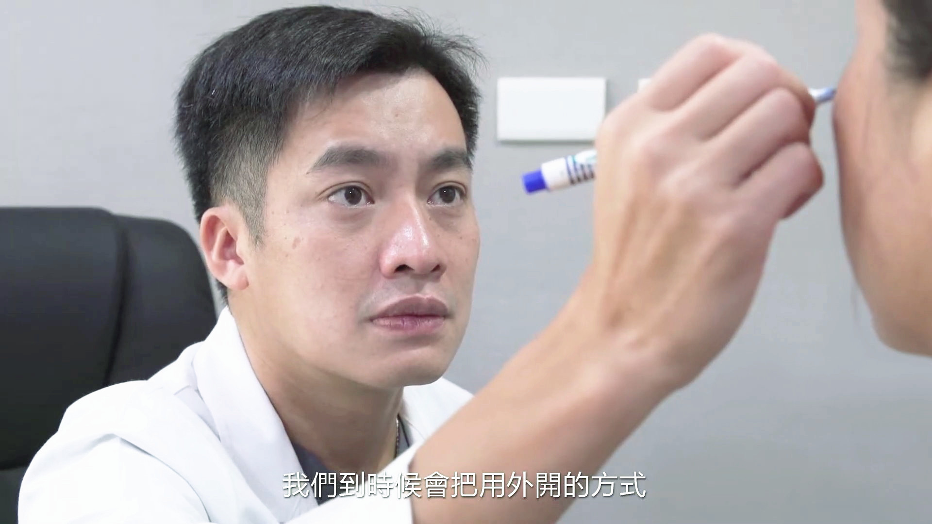 台北雷射汽化眼袋手術權威醫師推薦價格費用010