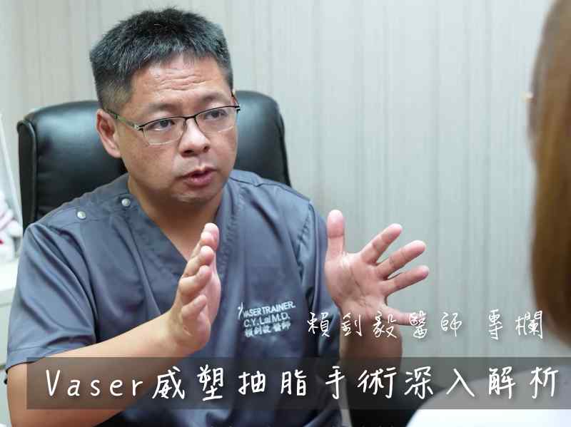 威塑脂雕抽脂手術常見問題Q&A完整揭密 - 台北亞緻 賴釗毅醫師