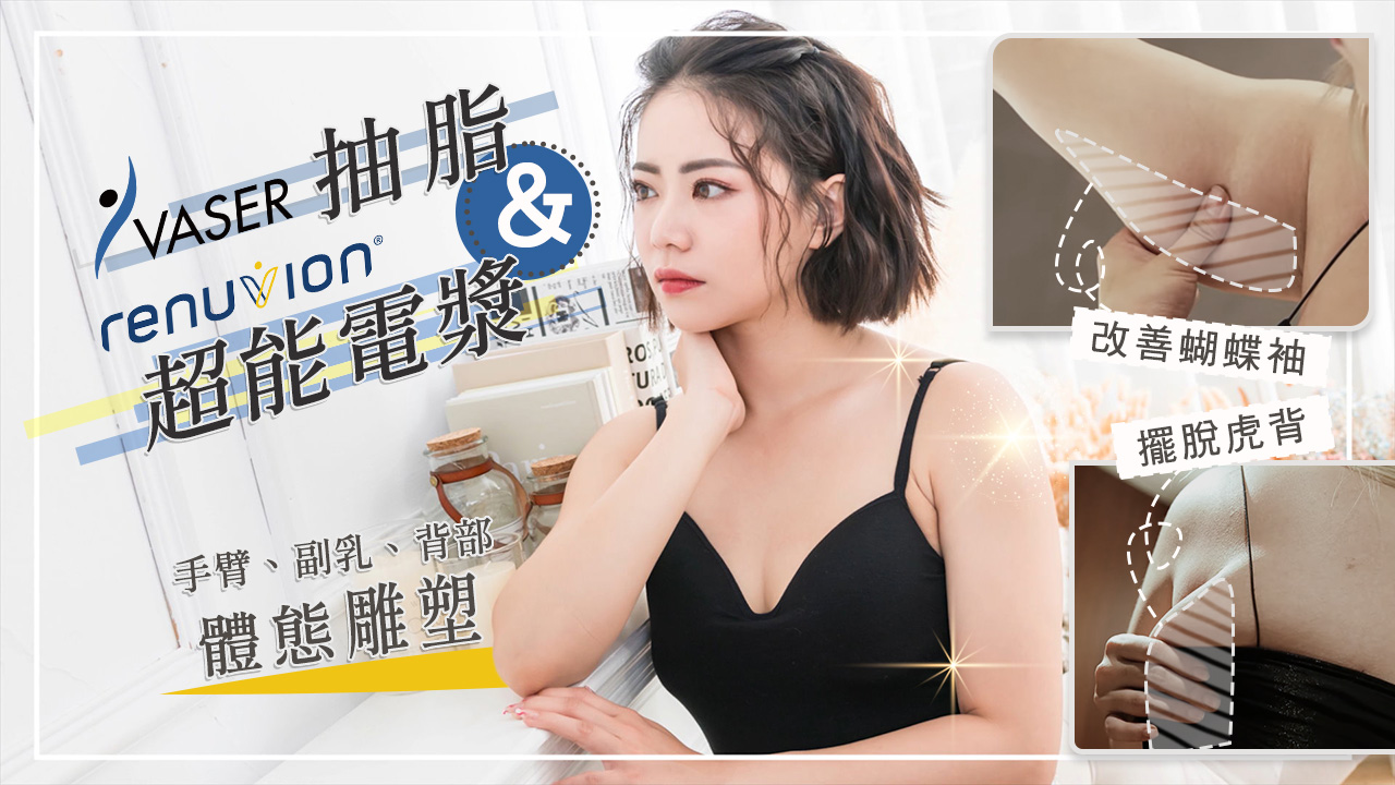Kell擺脫虎背掰掰袖 改善蝴蝶袖厚背肉 Vaser威塑抽超能電漿體態雕塑 台北抽脂亞緻整形TaipeiArt