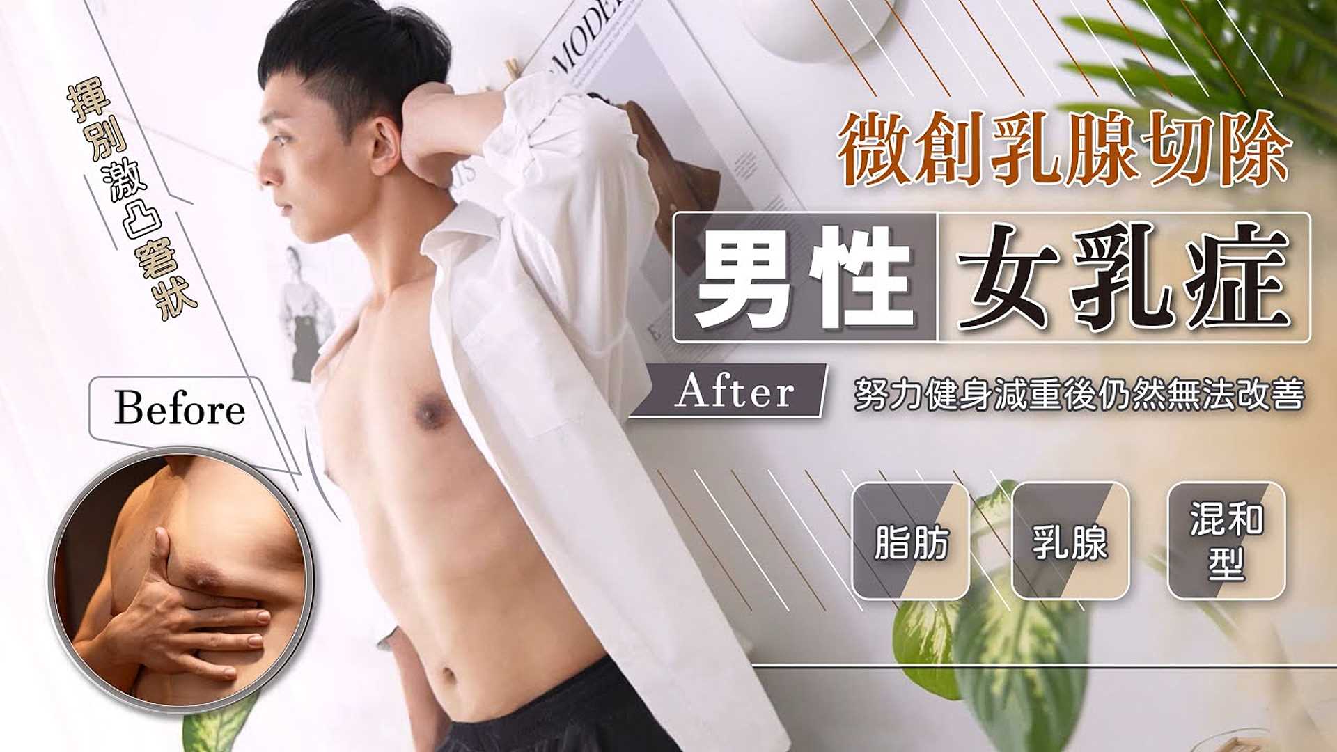 男性女乳症手術權威謝宇軒醫師台北亞緻007