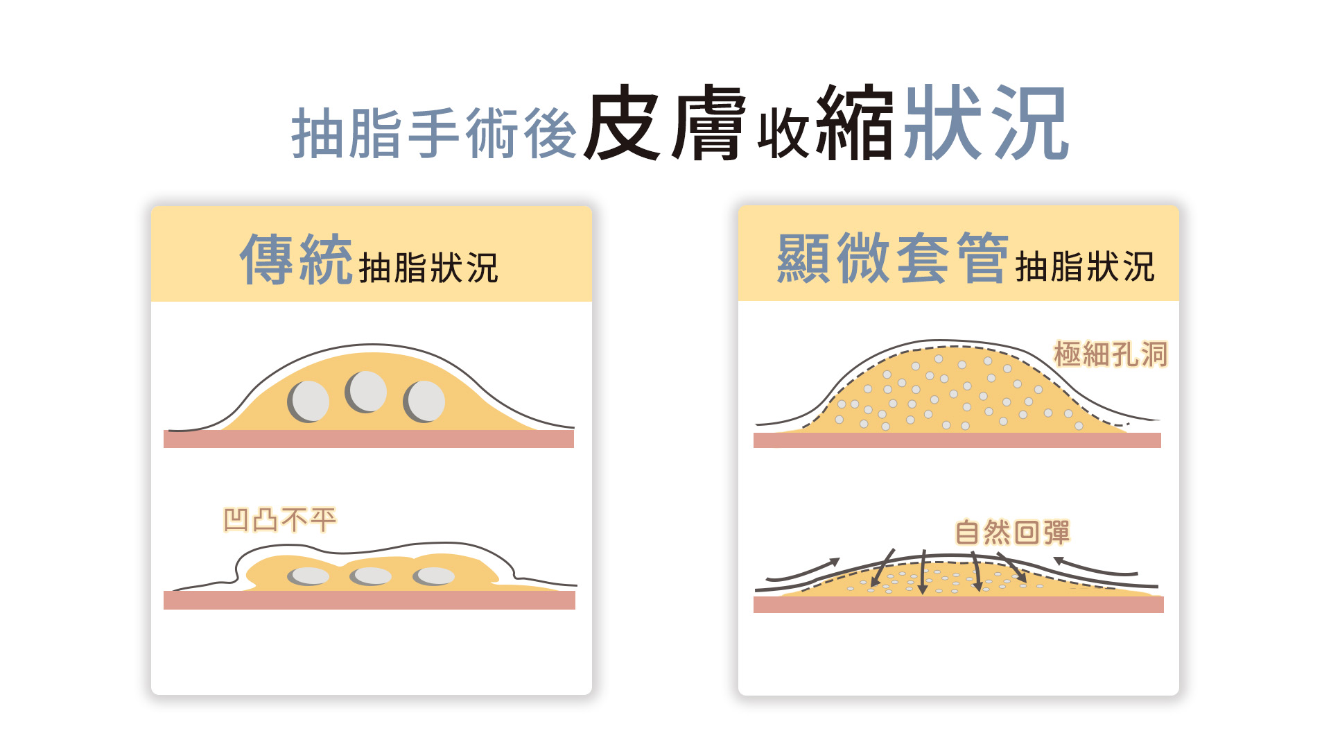 顯微套管抽脂台北亞緻003