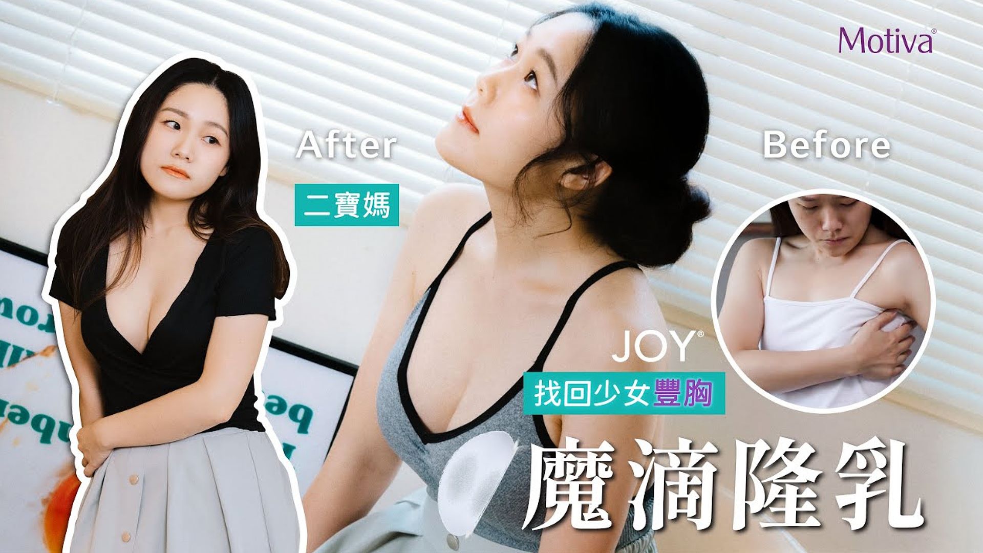 【魔滴隆乳2.0】產後身材困擾解決!二寶媽咪重拾豐滿與自信 台北隆乳亞緻整形