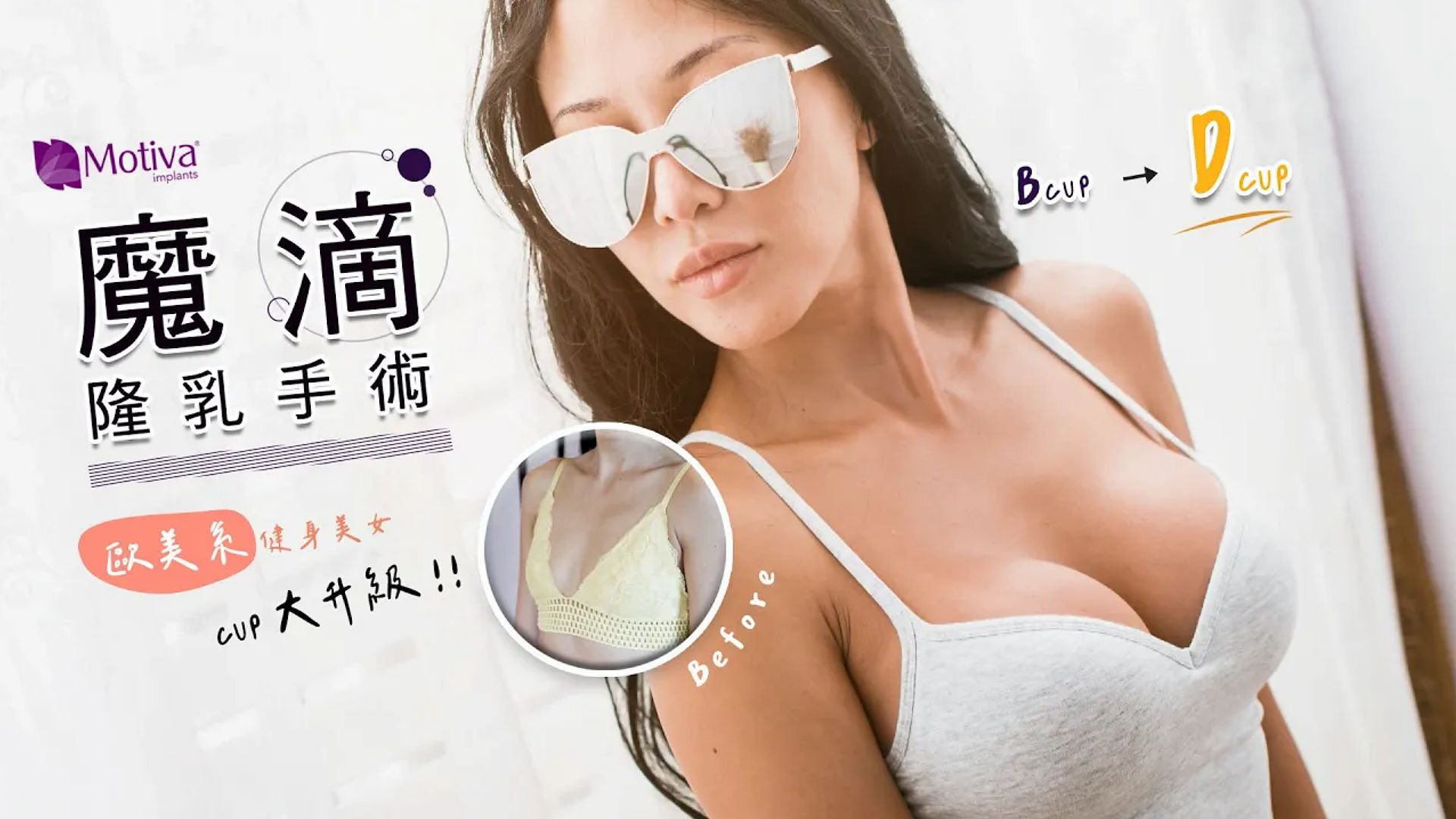 【魔滴隆乳2.0】健身辣妹美麗大升級 台北隆乳亞緻整形