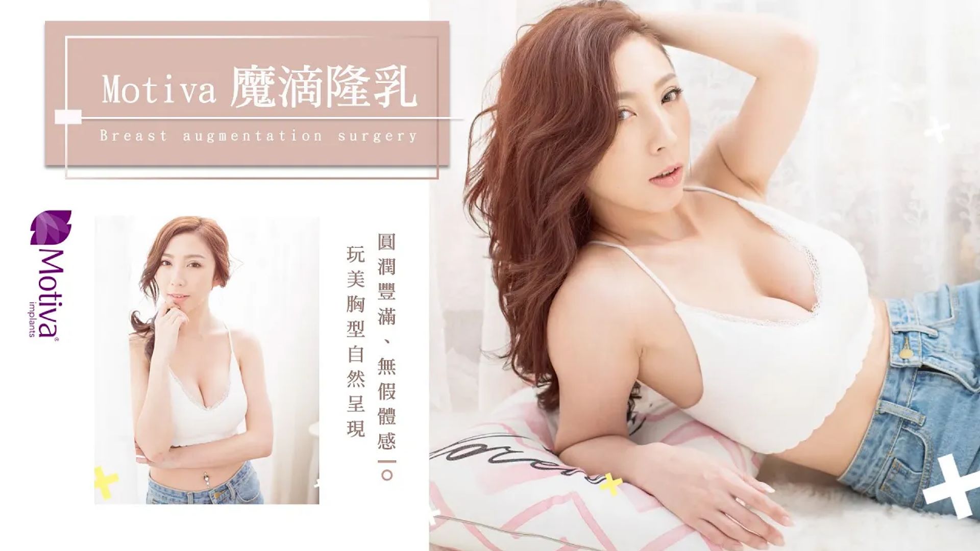 【魔滴隆乳2.0】魔滴隆乳自然胸型呈現 台北隆乳亞緻整形