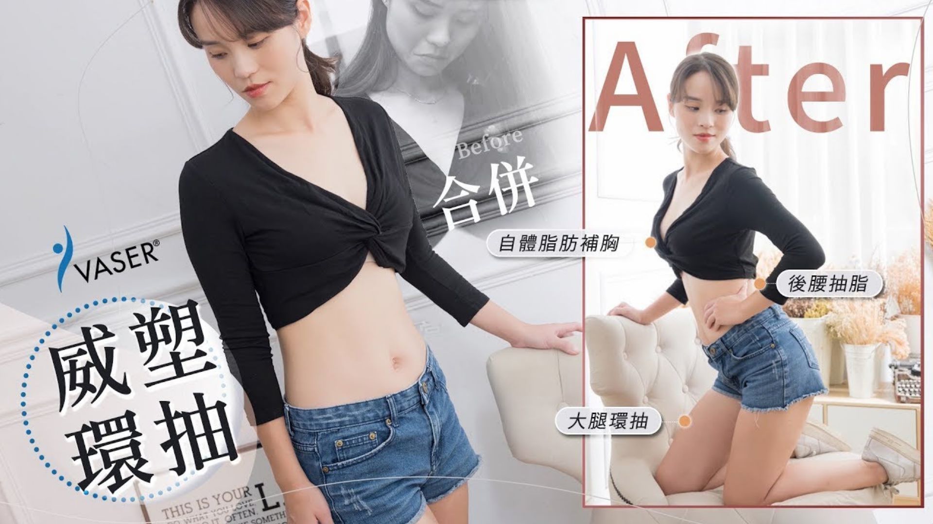 Nancy展現窈窕身姿 Vaser威塑大腿環抽後腰抽脂自體脂肪隆乳 台北抽脂亞緻整形TaipeiArt