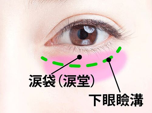 微創眼袋內開手術 台北亞緻TaipeiArts