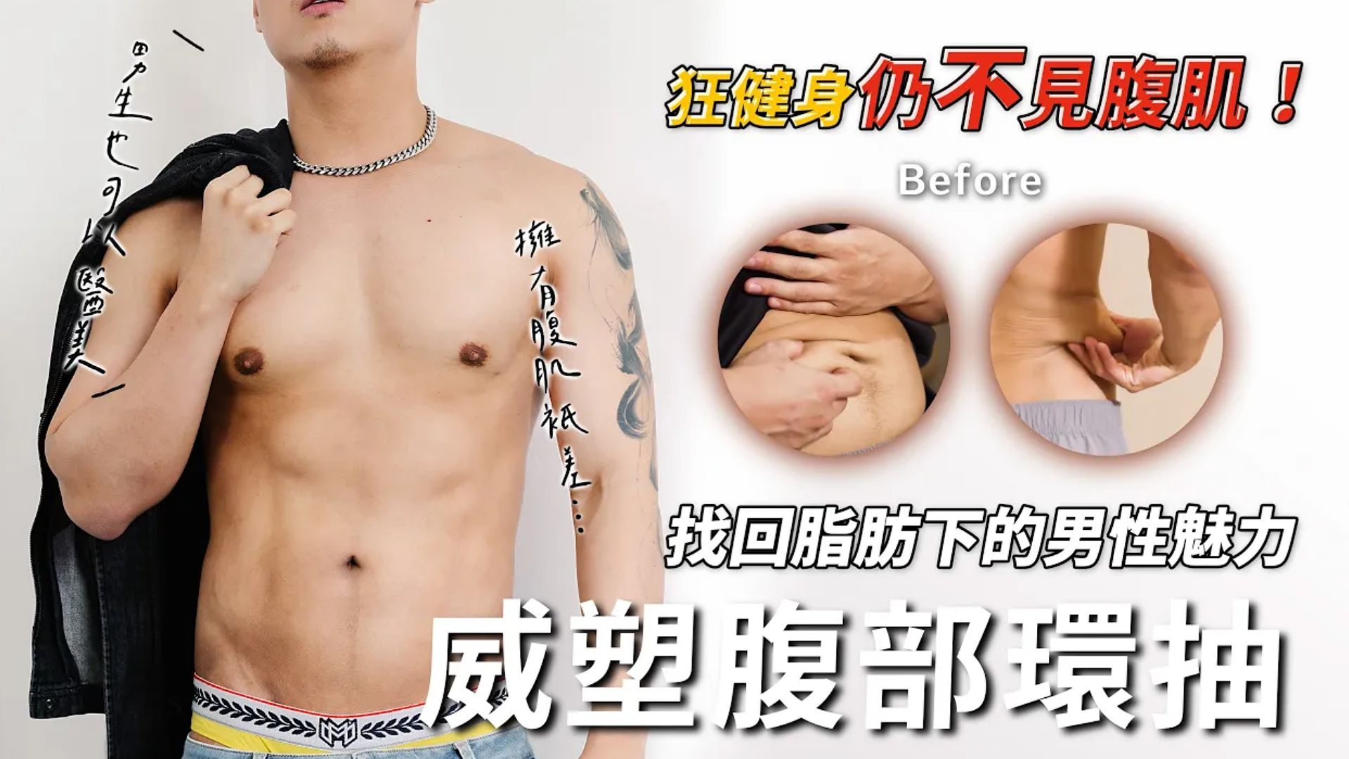狂健身仍不見腹肌？威塑腹部環抽 找回脂肪下的男性魅力！台北亞緻TaipeiArts 吳宗翰醫師