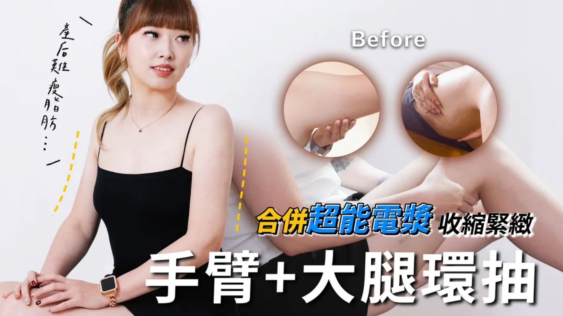 產後身材走樣？威塑環抽+超能電漿 重拾自信 擺脫身材焦慮！台北亞緻TaipeiArts 吳宗翰醫師
