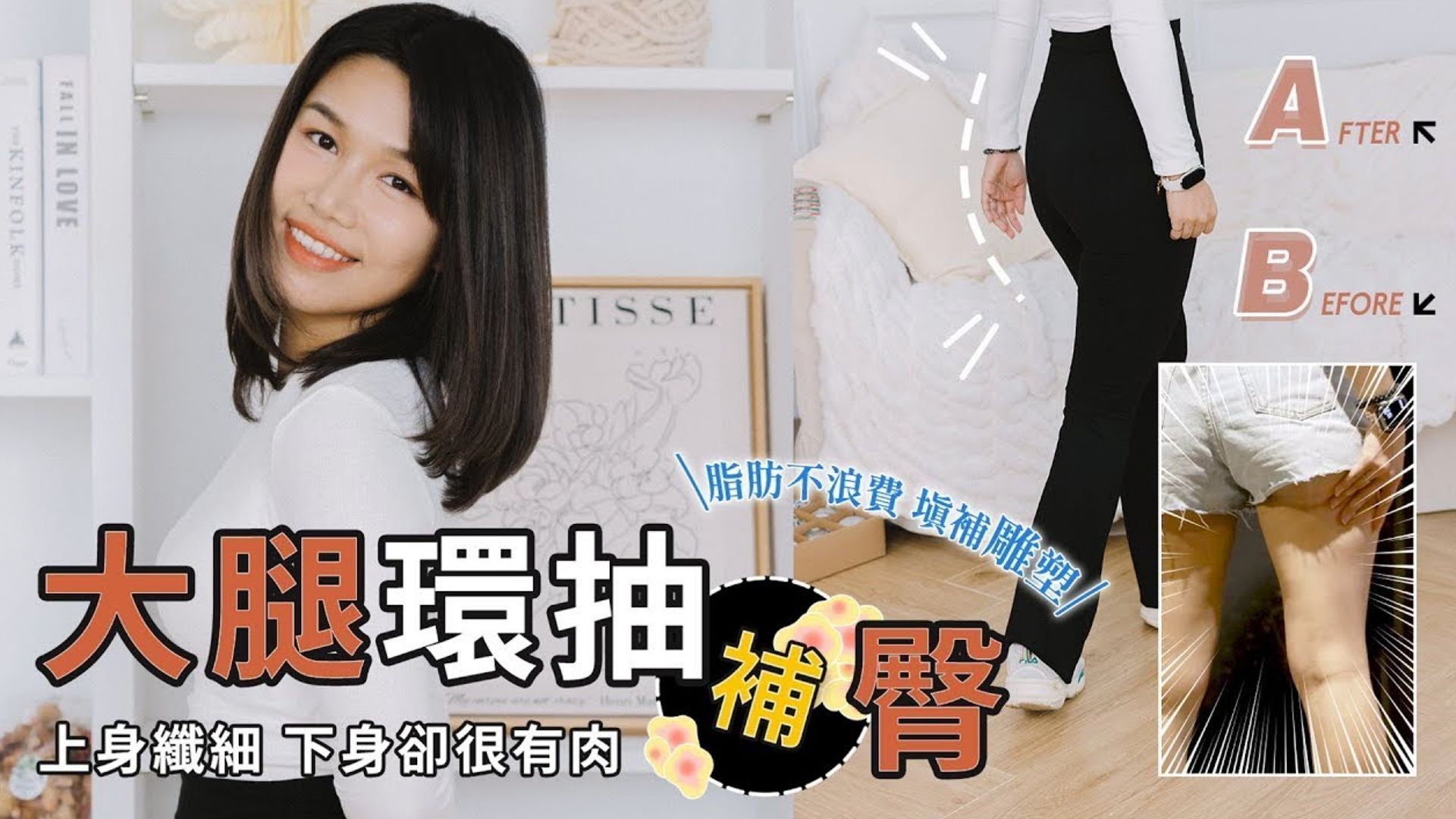 Vaser2.2威塑大腿環抽&超能電漿緊實&自體脂肪豐臀，Lillian擊退胖胖腿雕塑曼妙體姿 台北抽脂 亞緻整形TaipeiArts
