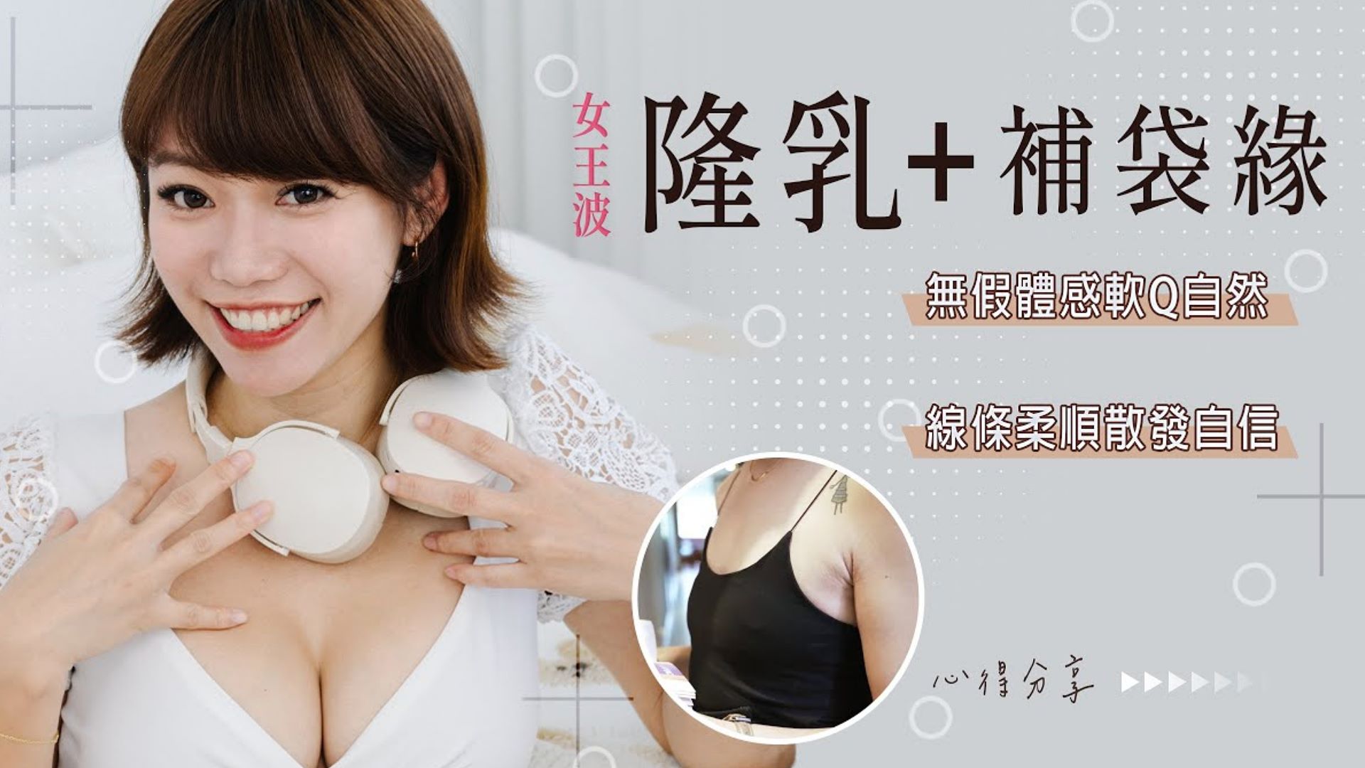 Xtra曼陀女王波 自體脂肪隆乳補袋緣 Yvonne胸湧罩杯升級 手術心得分享 台北亞緻TaipeiArts 王祥亞醫師