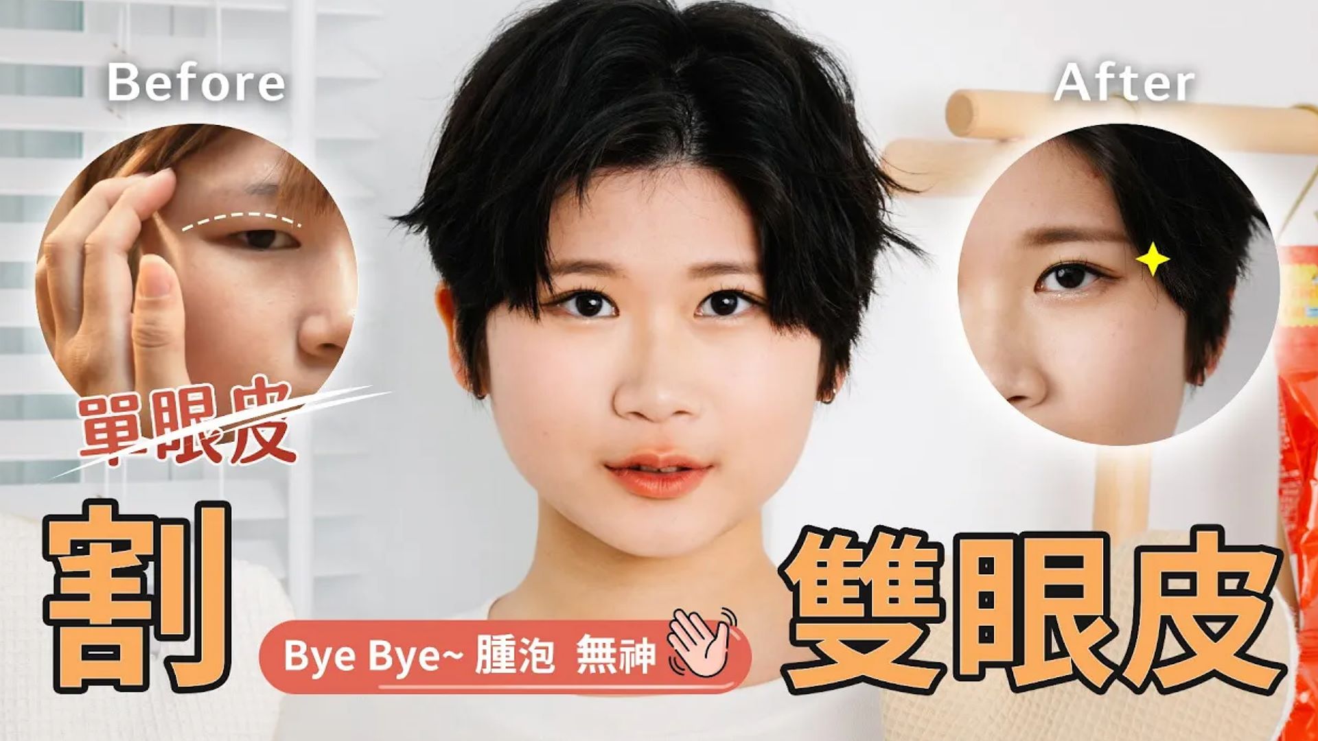 Rita的蛻變記 告別腫泡無神眼皮 迎接亮麗雙眸 割雙眼皮手術  台北亞緻TaipeiArts 謝宇軒醫師