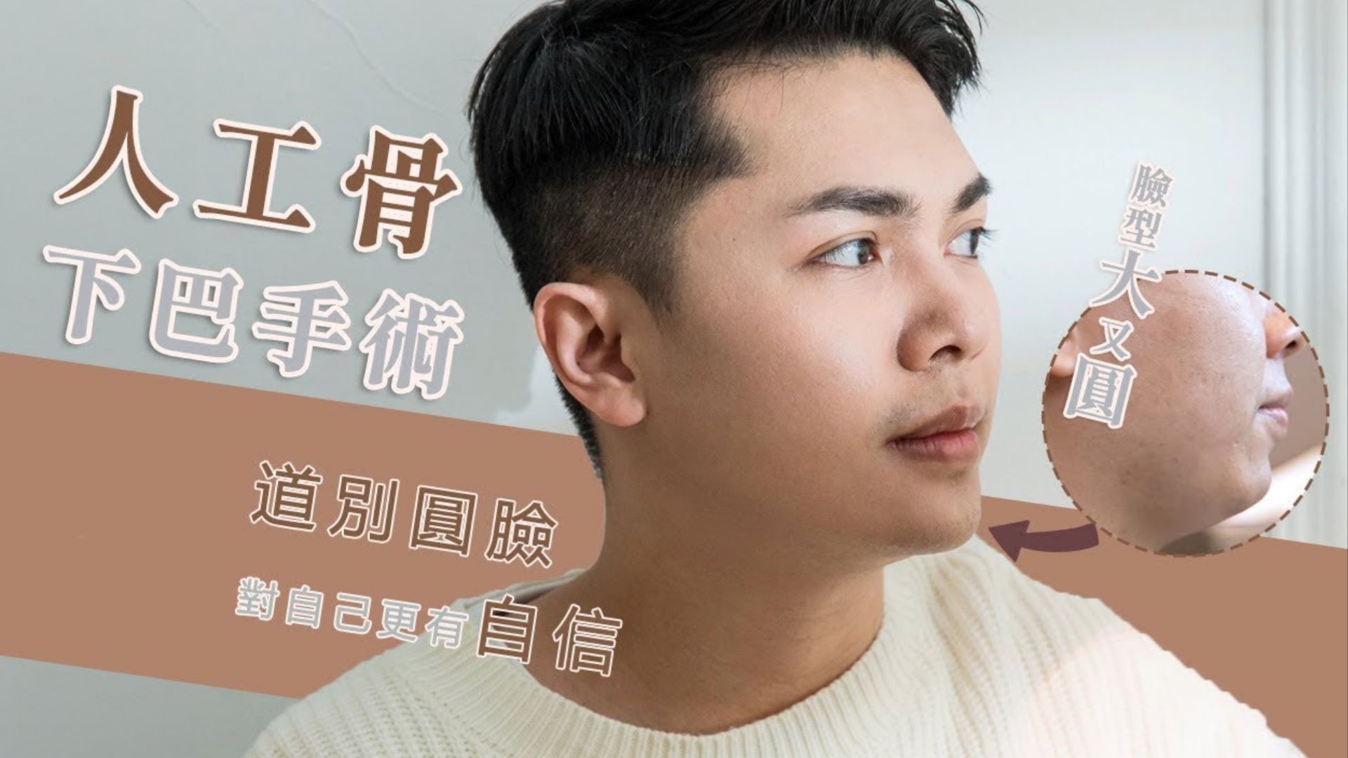 下巴手術卡特揮手道別圓圓臉 改善短小下巴 人工骨下巴手術 台北亞緻TaipeiArts 謝宇軒醫師