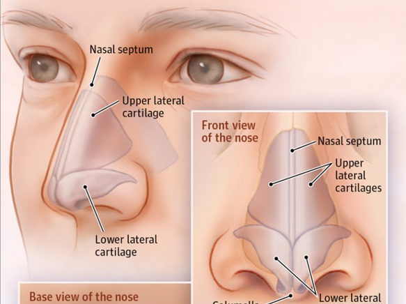 隆鼻手術 鼻整形